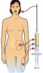 Face-Lipofilling-Tunisia